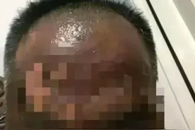 大家都错了！妻子开水泼丈夫后续：朋友曝光真相，两人都活该图片