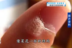 小心，武汉一女子做美甲竟感染HPV！医生提醒：这些美容项目尽量避免图片