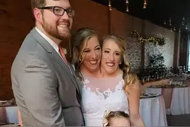 共享身体的双头姐妹中的一个结婚，网友对他们婚姻生活有很多疑问图片