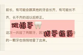 双排牙，拔牙经历~ 小记录图片
