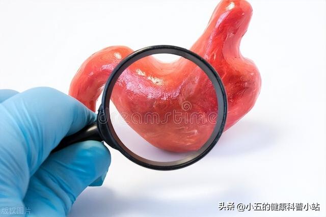 得了糜烂性胃炎怎么办？科学服用5种药物，有效保护和修复胃黏膜