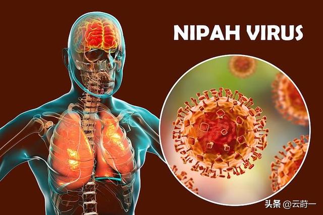 “尼帕病毒”来势汹汹，建议：每家备好5样东西，关键时刻能救命