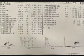 血小板增多不用治？医生提醒：别大意，尤其是中老年人！图片