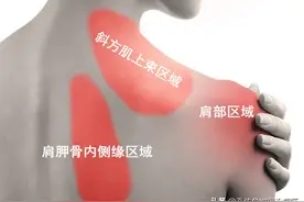 手麻、肩胛骨缝疼痛，是颈椎病吗？一文详细告知您常见的3大病因图片