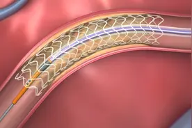 心脏支架后需要终身服药吗？哪些可停？哪些要吃一辈子？一文说清图片