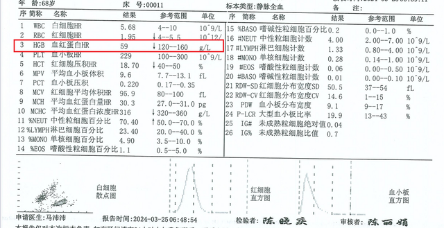 肝功球蛋白结果升高，原因竟然是因为这个疾病