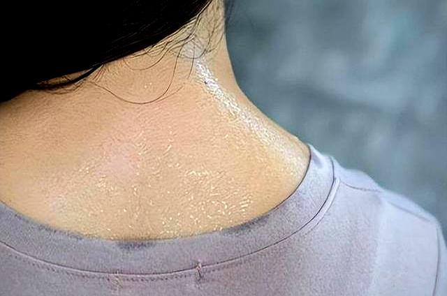 爱出汗=身子虚？错！研究发现：爱出汗的人，可能心肺功能更强大