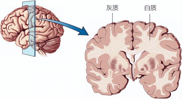 在人体实验中发现：酒喝得越多，脑容量越会变小，人就会越笨？