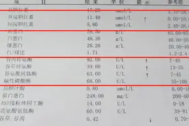 肝病患者最怕这2项升高，希望你一个都没有！图片