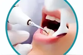 【口腔牙周】洗牙是世上投资回报率很高的一件事图片