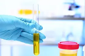 排尿很黄、异味很大？身体向你暗示的这3件事，可能与疾病有关图片