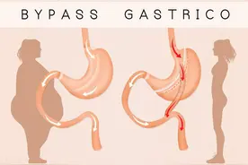 胃病用药 36 种全解析：反酸、胃胀、胃痛怎么选？避开 5 大误区图片