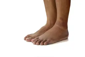 老年人出现腿、脚肿胀别忽视，这5种常见的病因，建议了解图片