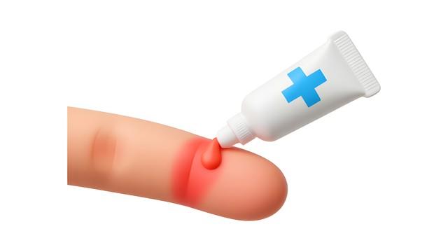 卤米松乳膏：为何能成为皮肤病治疗的常用选择？解析其使用方法