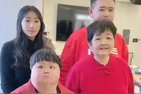 44岁网红美双去世，死因曝光，从小患有唐氏综合症，差点成为弃婴图片