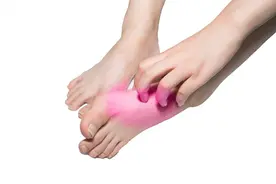 脚气是因为体内有湿气吗？医生推荐：用一物泡脚或可以预防图片