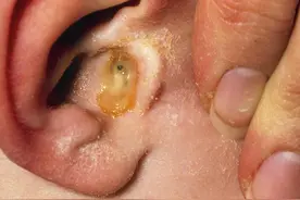 还有多久活，摸摸耳朵就知道？提醒：长寿的老人，耳朵有3个特别图片