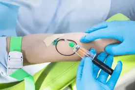 肿瘤标志物检测：癌症早期诊断的利器图片