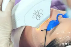 美容科普，夏季可不可以做光子嫩肤？图片