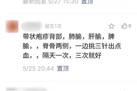 一般带状疱疹几天能好？图片