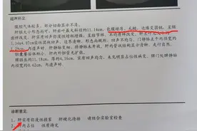 从肝纤维化到肝硬化仅半年，逆转肝纤维化做好这2点图片