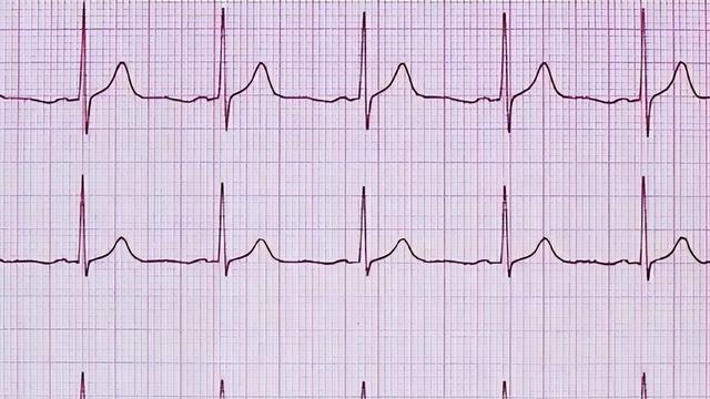 “经常运动”被推翻？医生建议：过了55岁，最好保持7个锻炼习惯
