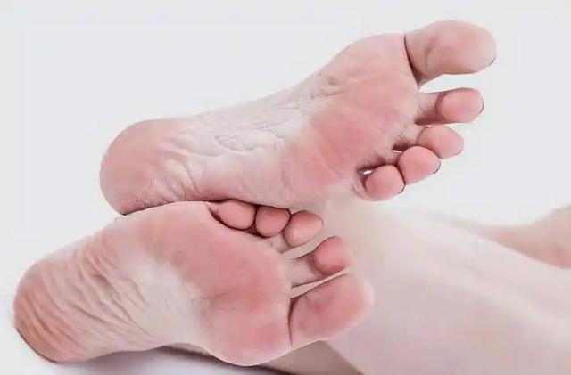 糖尿病足都有什么症状?需要注意什么?内分泌科医生一文详解