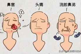 带你认识鼻窦炎，拿小本本记好图片