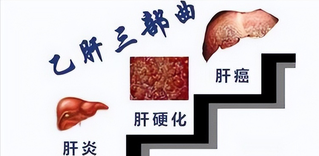 B超提示脾脏大小正常，是真的“正常”吗？