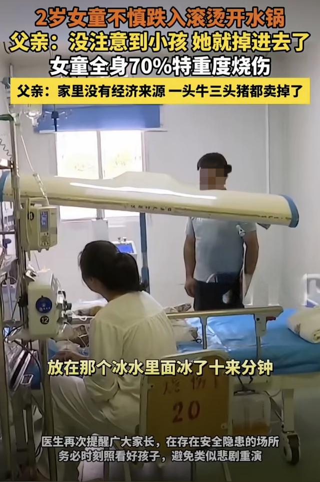 2岁女童跌入开水锅！70%烫伤背后，三秒疏忽一生伤痛