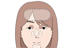 不要害羞！这些部位长“痘痘”，身体可能预示大问题，别不当回事图片