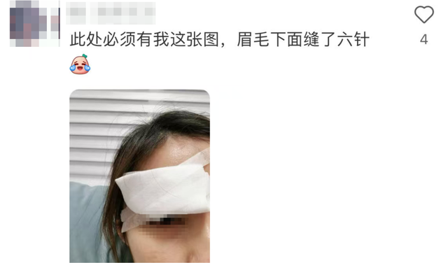 “杀伤力”如此惊人！上海人都喜欢的这项运动，已致多人受伤！插入眉骨、扎穿手指，凶器竟是