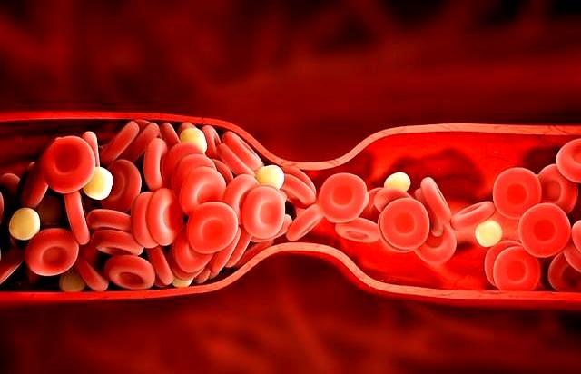 每周2次这类运动，不仅抗衰老，心脏变好了三高降低了骨骼也强健