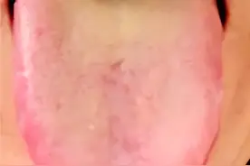 高血压多是肝这里虚了，一个中成药，滋肝潜阳，清热降血压图片