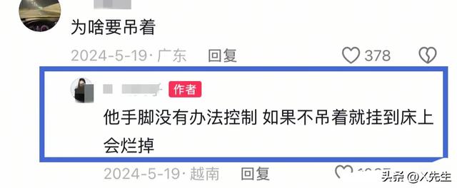 解脱了！越南“蝴蝶宝宝”去世，20多根绳子绑在床上，挂了50多年
