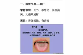 舌苔“地图”揭秘脾胃健康，9大中成药来帮忙图片