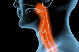 咽部有异物感，但总查不出问题！医生：不及时对症治疗会加重病情图片