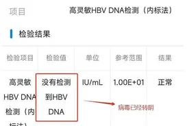 乙肝抗病毒治疗超1年，病毒量低于这些才算安全图片