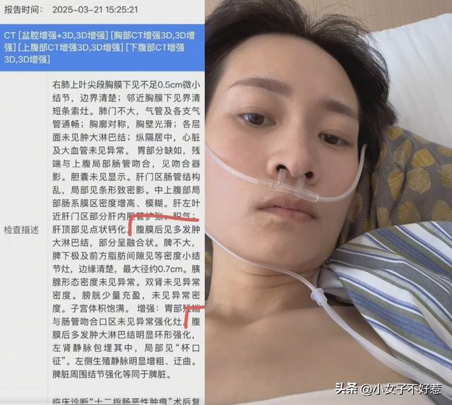 辽宁美女刘丽去世，年仅34岁！死因曝光，丈夫悲痛发布讣告