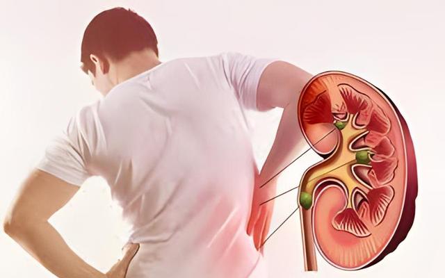 一天10次！48岁男子确诊肾衰竭，妻子痛哭：劝了多次都不听