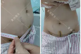 健身教练宝妈产后小肚子，怎么练也减不下来，一个办法搞定了！图片
