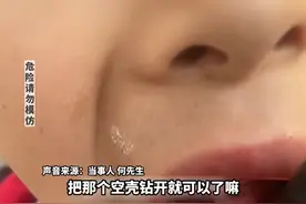 大无语！孩子牙痛，父亲竟用电钻来钻牙洞。网友们在评论区炸锅了图片