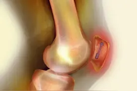 一个被低估的中成药，把关节里的陈年寒湿"拔"出来！图片