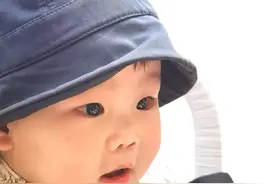 打麻腮风第9天图片