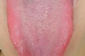 这个药，疏肝强过逍遥丸，不仅理气健脾，还能活血化瘀图片