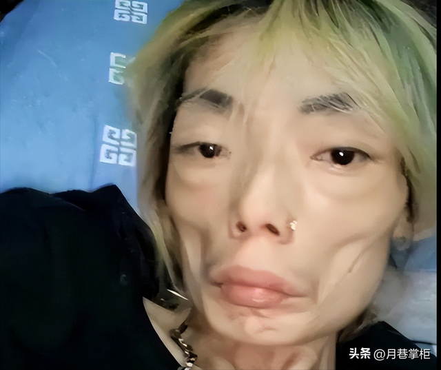 一代女神沦为豪门玩物？结婚8年牙齿全掉，器官切除，面似骷髅