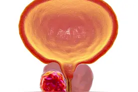 小便时尿道刺痛是怎么回事？半数女性都有过这种困扰，如何缓解图片