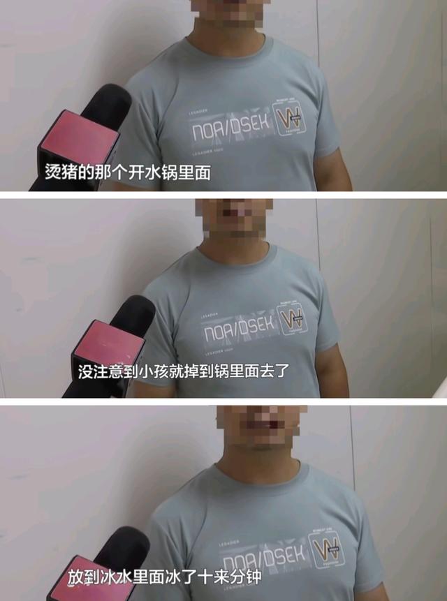 2岁女童跌入开水锅！70%烫伤背后，三秒疏忽一生伤痛