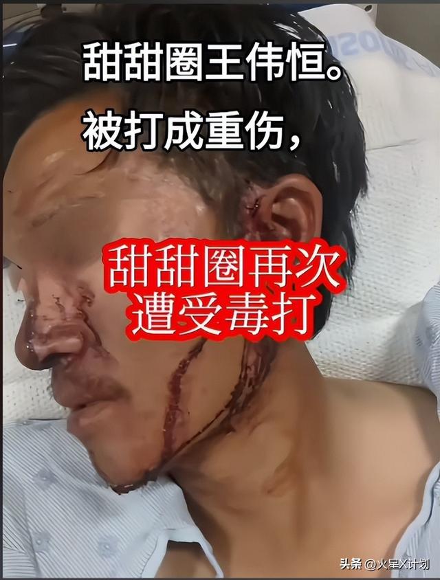 捧着甜甜圈、高呼我爱美国的王伟恒，如今成过街老鼠自作自受