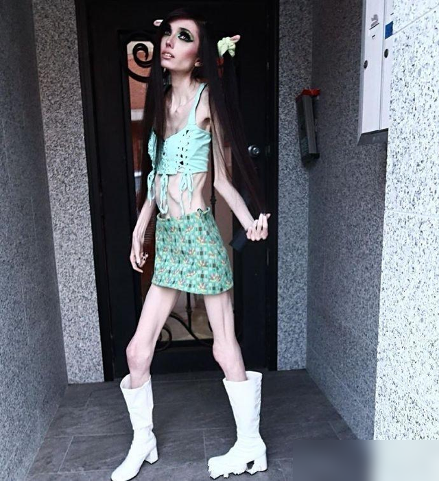 中年女人“运动前后”，再穿同一件衣服：差距好大，对比就懂了